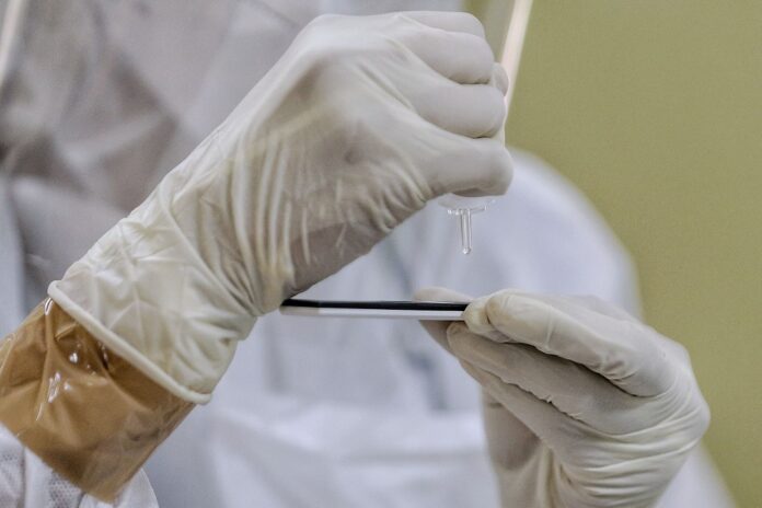 Dr Noor Hisham: Over 92,000 RTK-Ag tests conducted yesterday