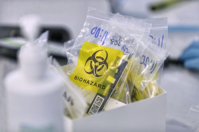 MOH gives conditional approval to two Covid-19 self-test kits