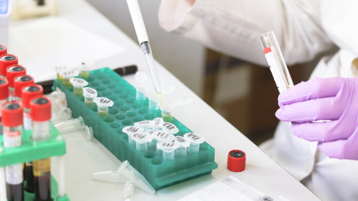 Sarawak Research Development Council inks MoUs for biomedical research, human capital training
