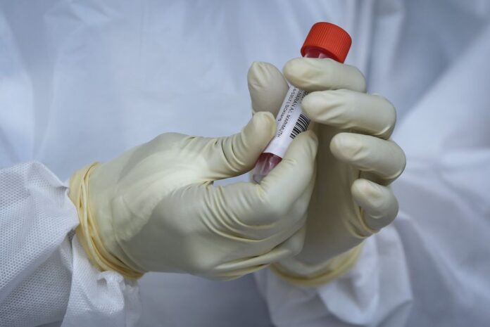 Unimas: Delta cases make up 73pc of Covid-19 infections in Sarawak, 90pc in Kuching