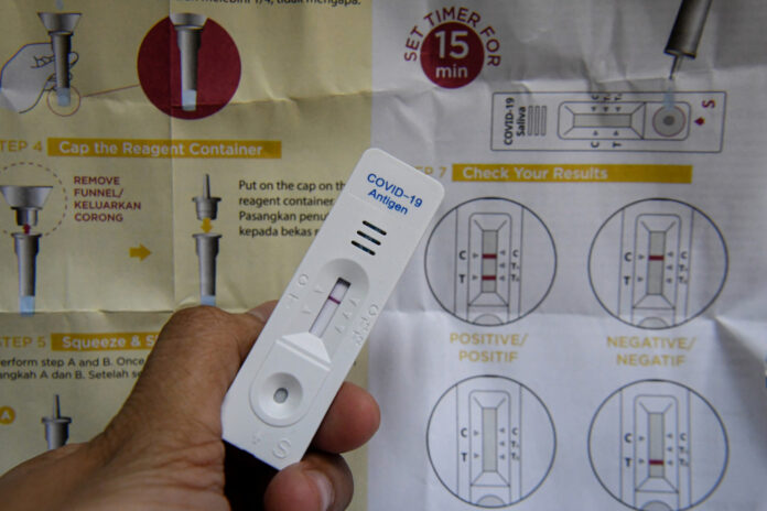 Covid-19: Sabah deputy CM urges industrial players to test staff using rapid antigen test kit