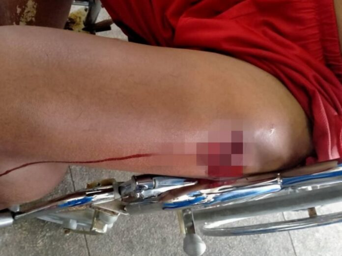 Man survives crocodile attack in Kota Samarahan