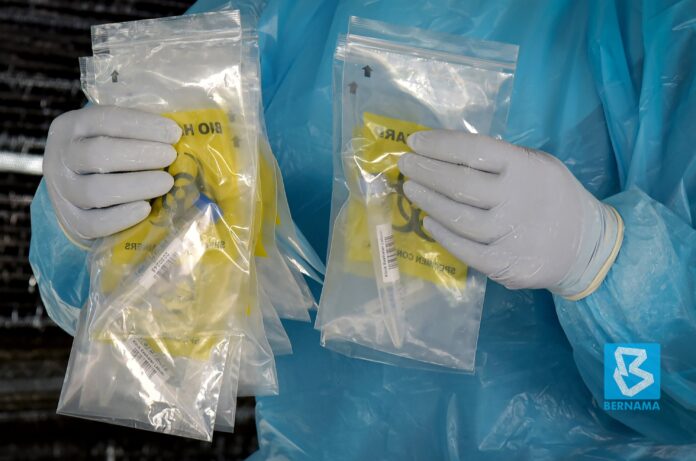 Covid-19 cases drop to 1,273 in Sabah