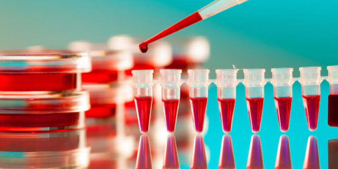 Japan team carries out world-first spinal cord stem cell trial