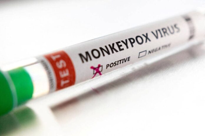 Health agency confirms community spread of monkeypox in England