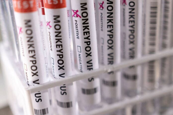 US doctors urged to test for monkeypox, CDC says risk to public low