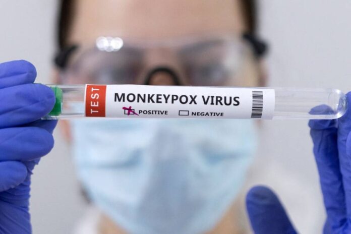 New York asks WHO to re-name 'stigmatizing' monkeypox
