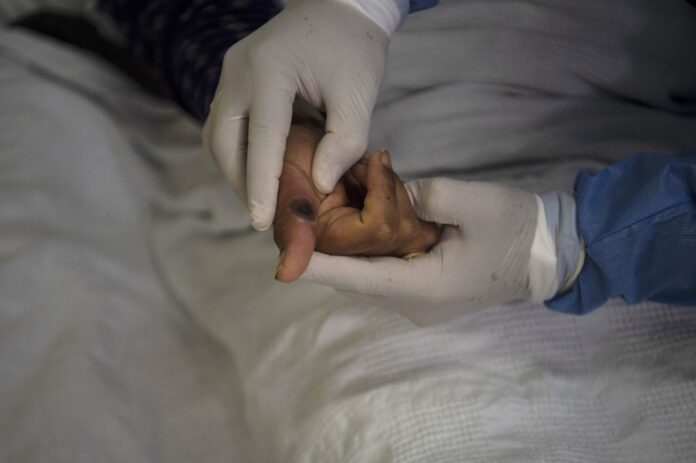 Indonesia records first case of monkeypox