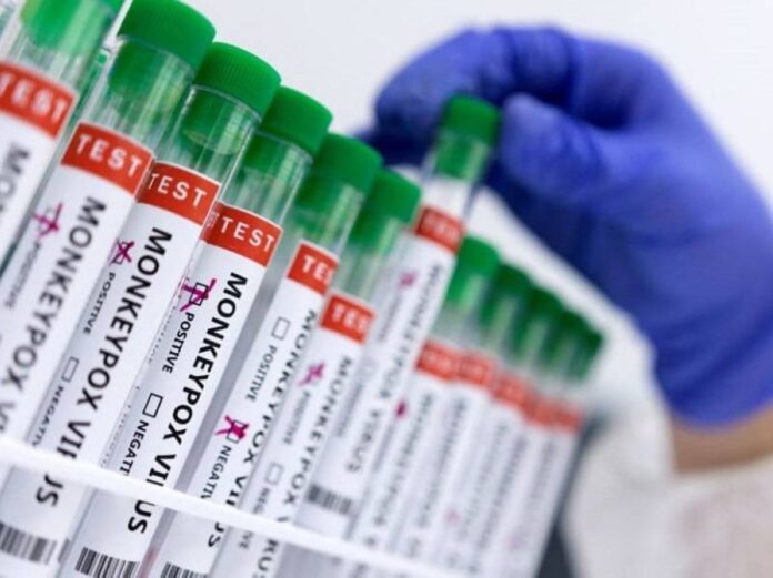 Report: Biden administration to allow new injection method for monkeypox vaccine