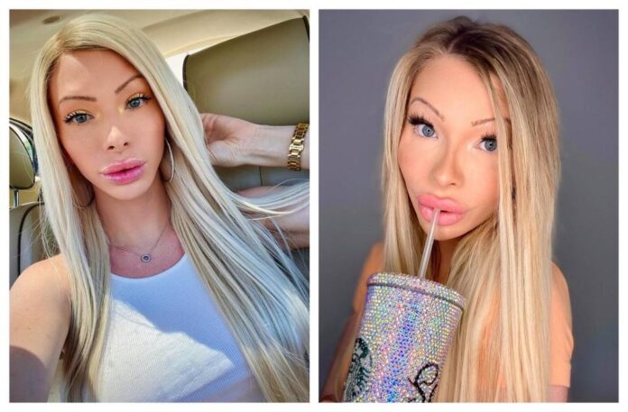 American woman who spent over RM200,000 on plastic surgery says it helps boost her confidence, makes her happy