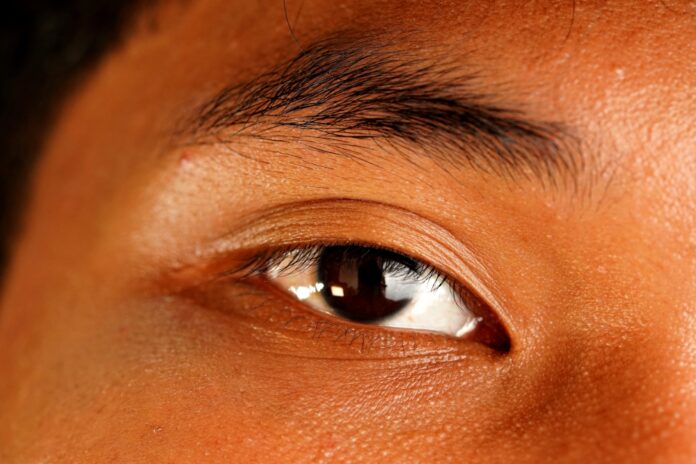 Droopy eyelids may signal underlying health condition, not just cosmetic issue